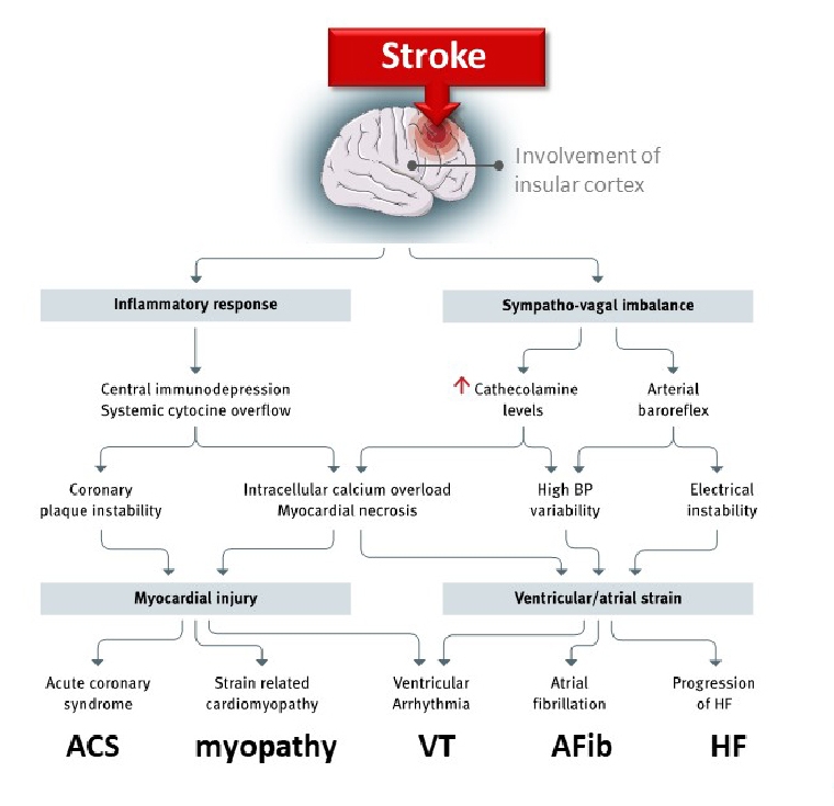 Stroke as Interdisciplinary Disease What the Practising Cardiologist